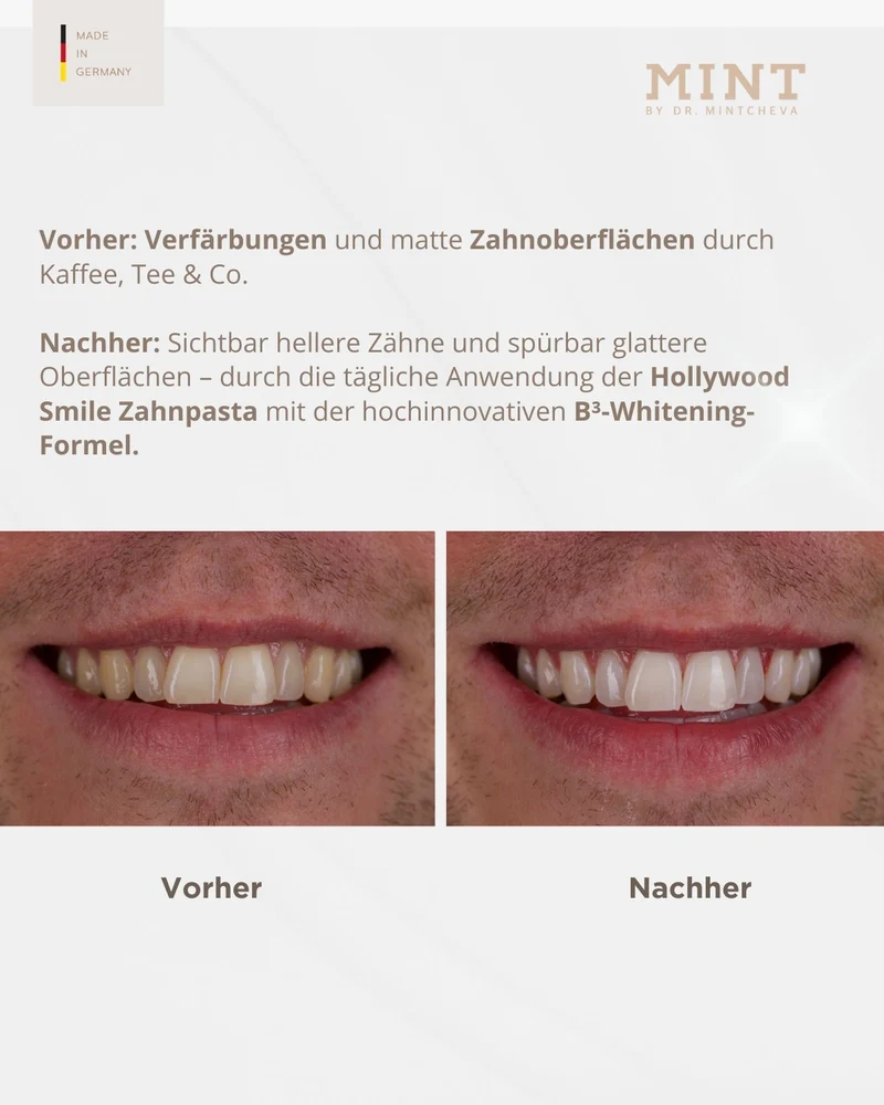 Set Hollywood Smile Zahnpasta & Polish Zahnbürste im Doppelpack