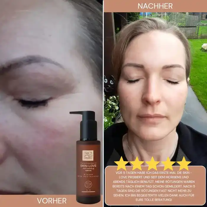 SKIN-LOVE - Wildrosen Serum mit Aloe Vera & Hyaluron Bio-Naturkosmetik 100m