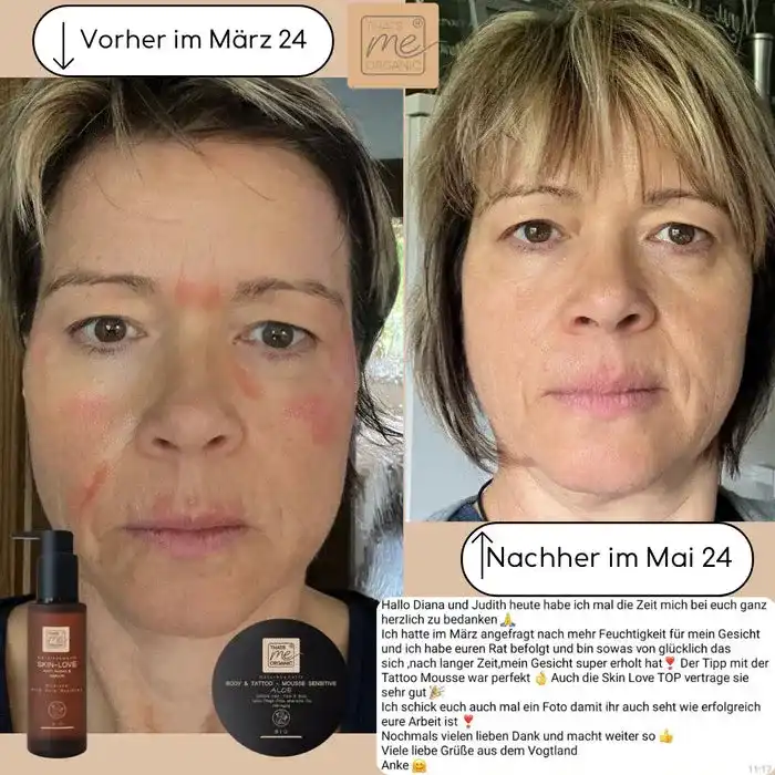 SKIN-LOVE - Wildrosen Serum mit Aloe Vera & Hyaluron Bio-Naturkosmetik 100m