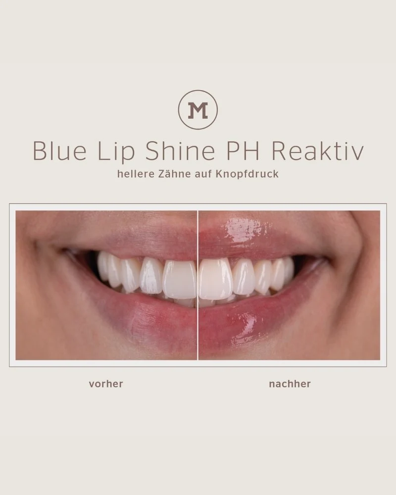 BLUE LIP SHINE PH LIP GLOW