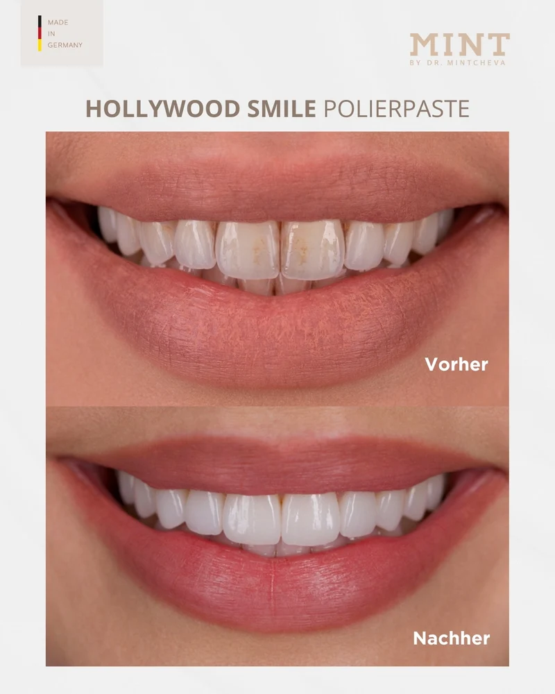 Set Hollywood Smile Zahnpasta & Polierpaste