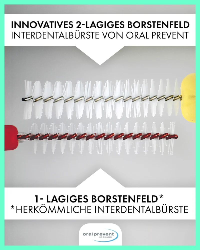Interdentalbürsten Smart Grip von ORAL PREVENT