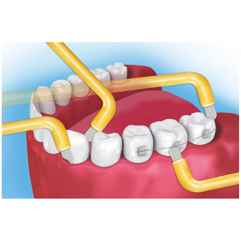 Oral Prevent Einbüschelbürsten Mono Clean soft - Plaque- und Kariesprävention
