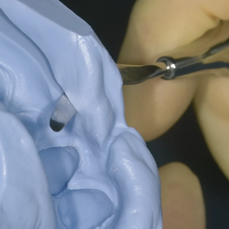 KKD U-Cutter nach Dr. M. Ugrinovic