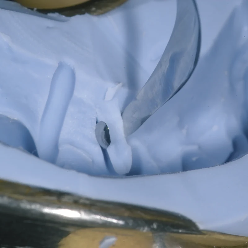KKD U-Cutter nach Dr. M. Ugrinovic