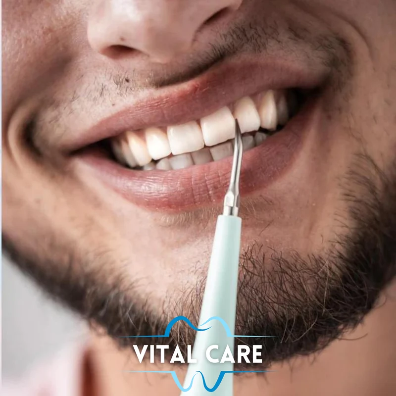 VITAL CARE | Kit dentaire ultime 2 en 1 : Blanchiment et nettoyage efficaces