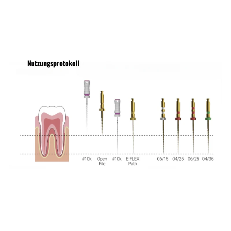 Wurzelkanalinstrumente E-FLEX GOLD NiTi | 5er Pack oder MixPack (6 Stück)