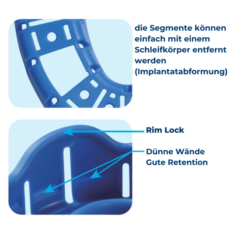 Einweg Abdrucklöffel | verschiedene Größen | 10 Stück