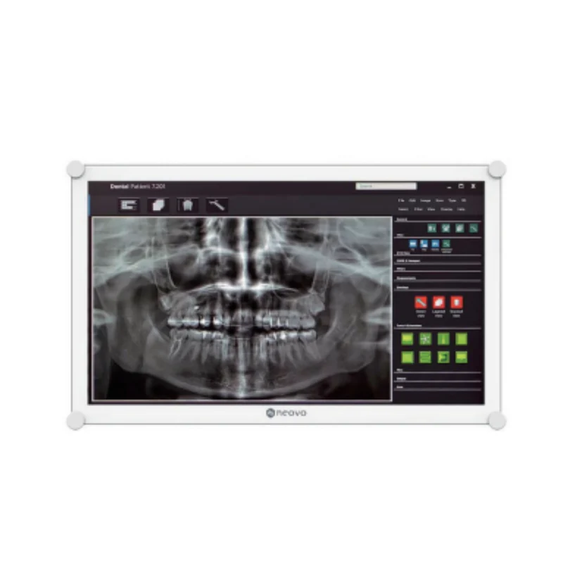 Dental LCD Monitor AG neovo| 22" | FHD 1920 x 1080 | RS-232-Schnittstelle | 8-Bit-Farbtiefe
