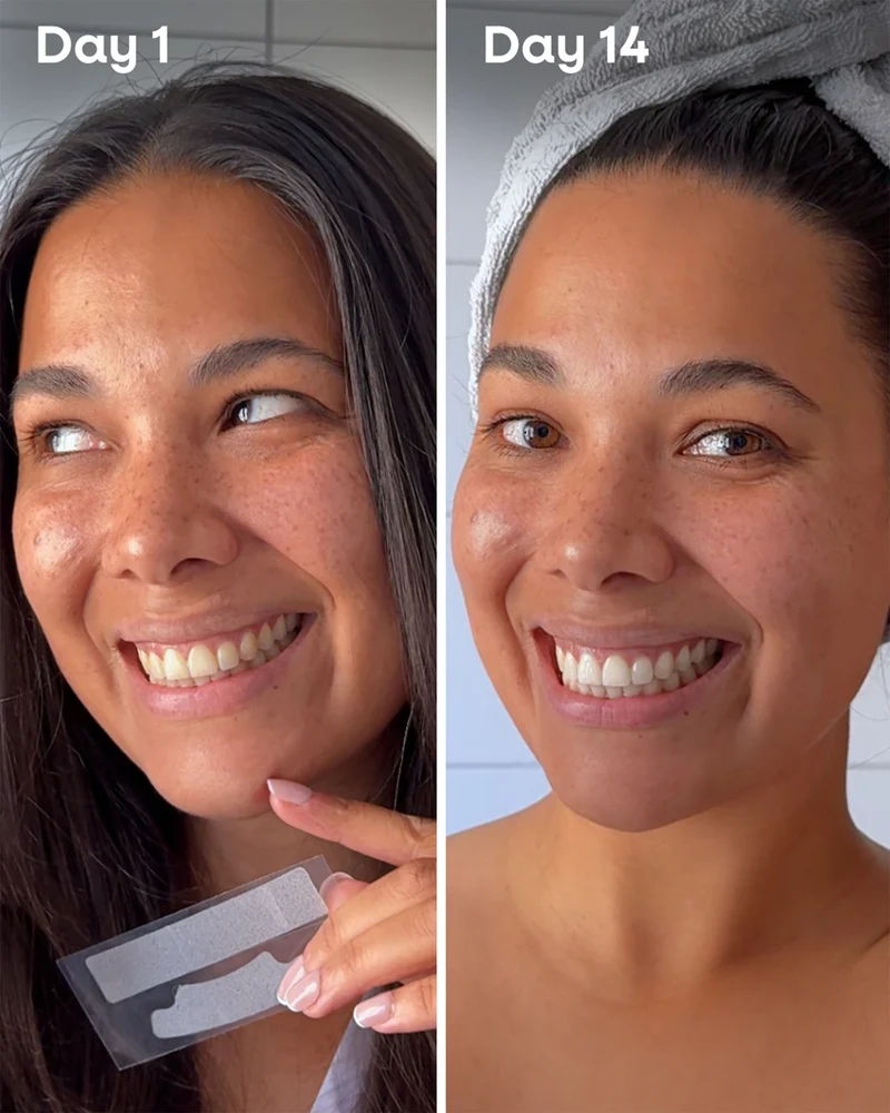 Whitening Strips- Aloe vera