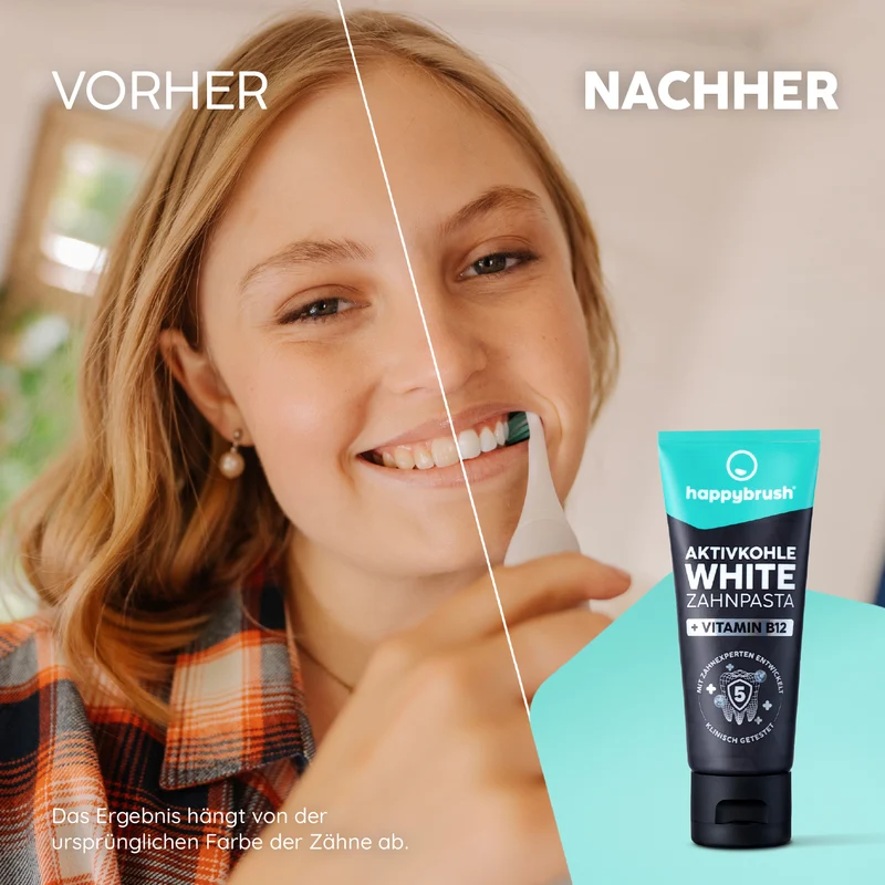 Aktivkohle White Zahnpasta