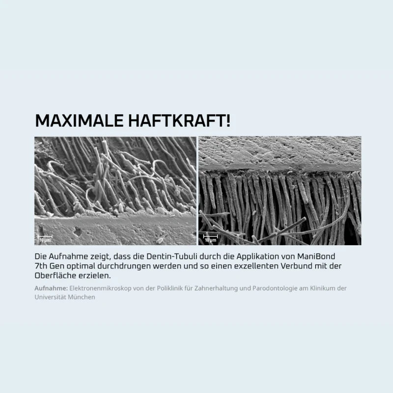 ManiBond 7th Gen | Einkomponenten Adhäsiv | selbstätzend & lichthärtend | 5 ml