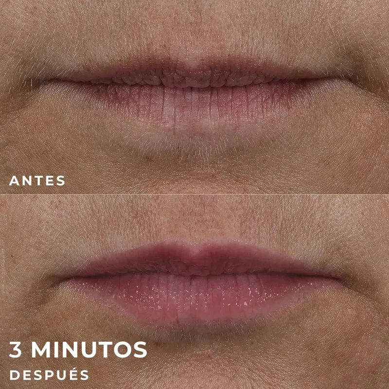 Roc Skincare Iberia Roc® Derm Correxion® Lip Volumizer 10Ml