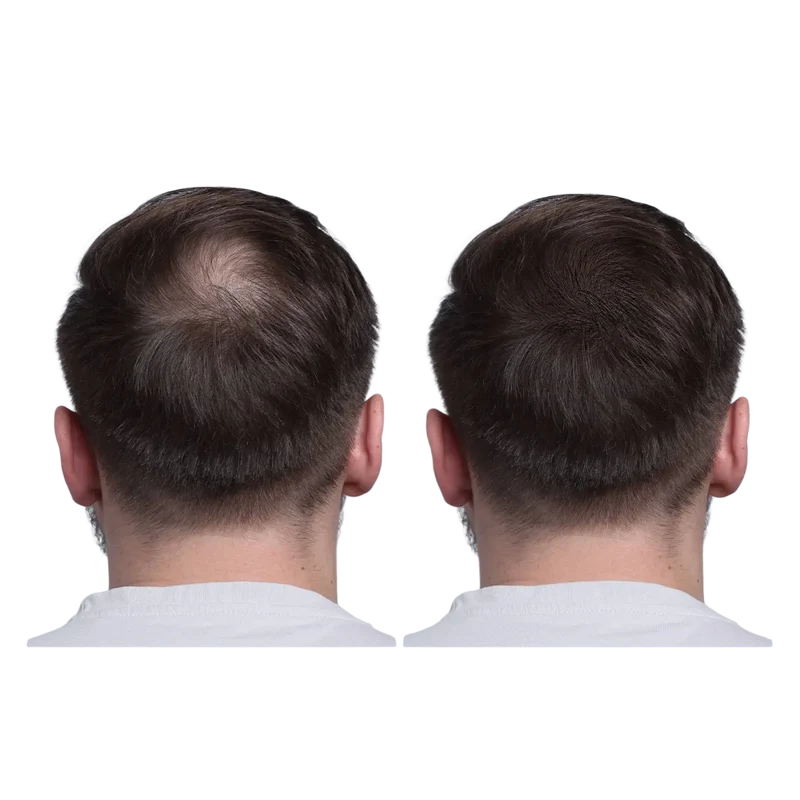 Schwarzer Reiswasser Spray Haarserum