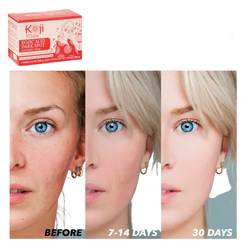 Koji White – Kojic Acid Dunkle-Flecken-Korrektur Seife